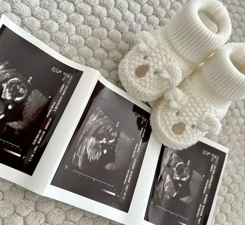 ultrasound_